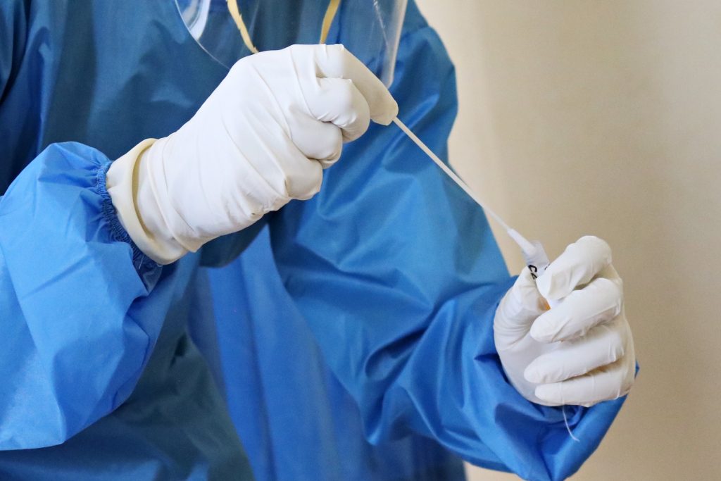 COVID-19 swab tests